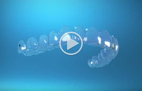 Invisalign Video Total Orthodontics in Greenwood Village and Lone Tree CO