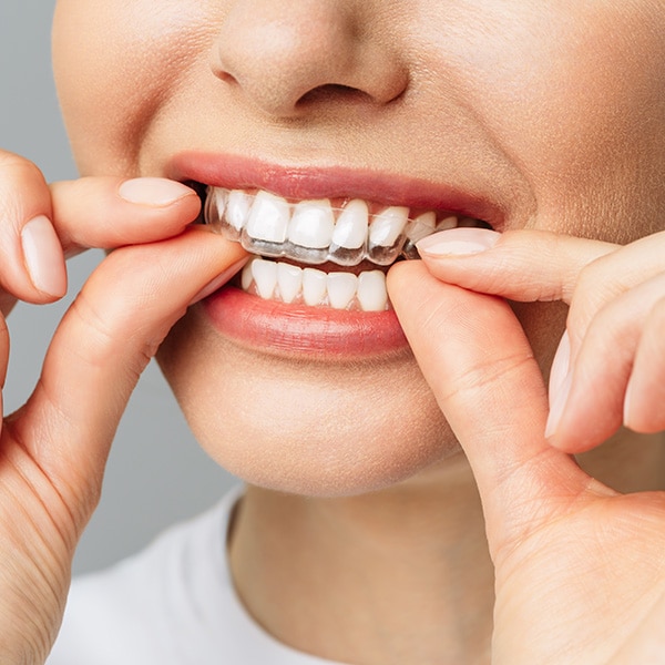 Invisalign Total Orthodontics in Lone Tree and Greenwood Village, CO