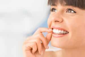 How Long Will My Orthodontic Treatment Take? Total Orthodontics in Lone Tree and Greenwood Village, CO