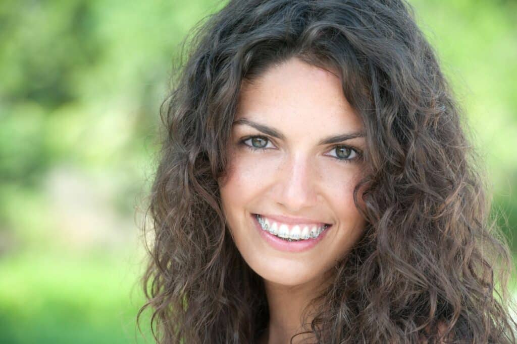 What to Expect Before Getting Braces? Total Orthodontics in Lone Tree, CO